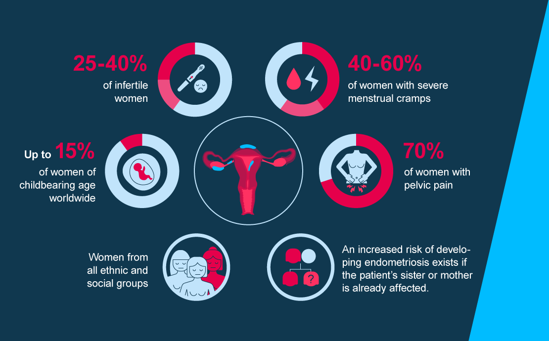 endometriosis-infographic1